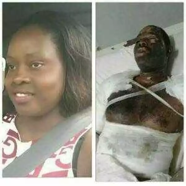 Cheating Wife Burns Hubby With Petrol After He Caught Her On Bed With Another Man (Photos)
